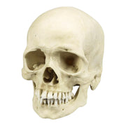 Replica Human Skull with Syphilis