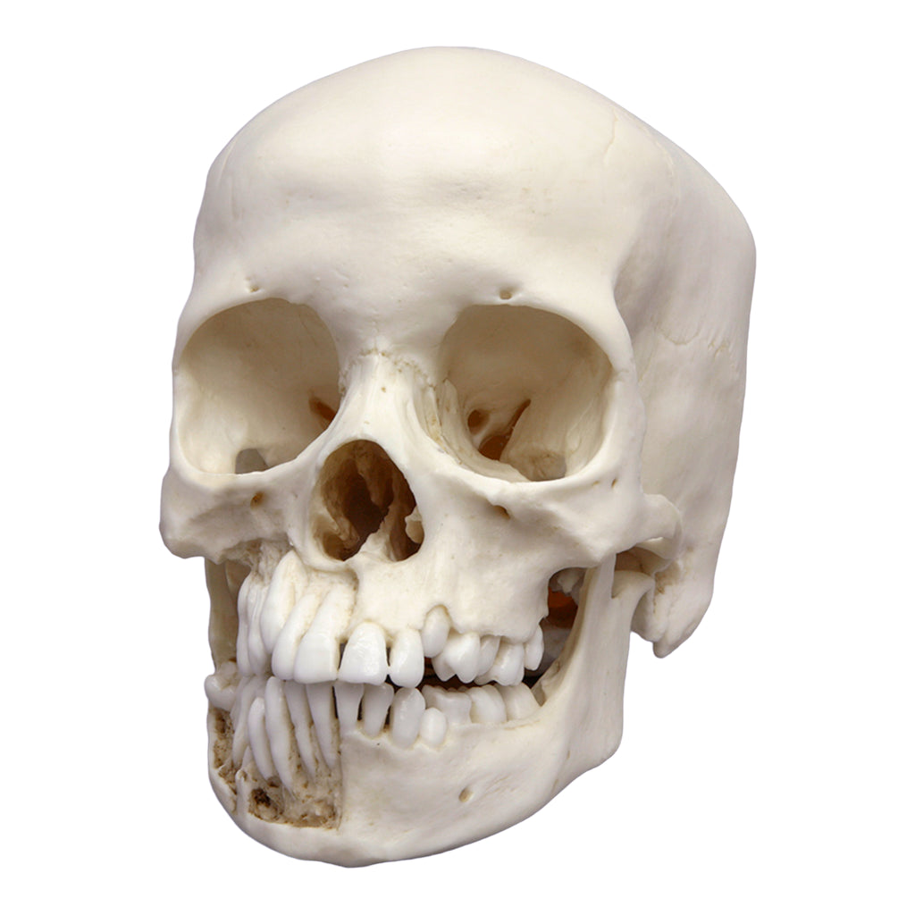 Replica 5-year-old Human Child Skull with Dentition Exposed