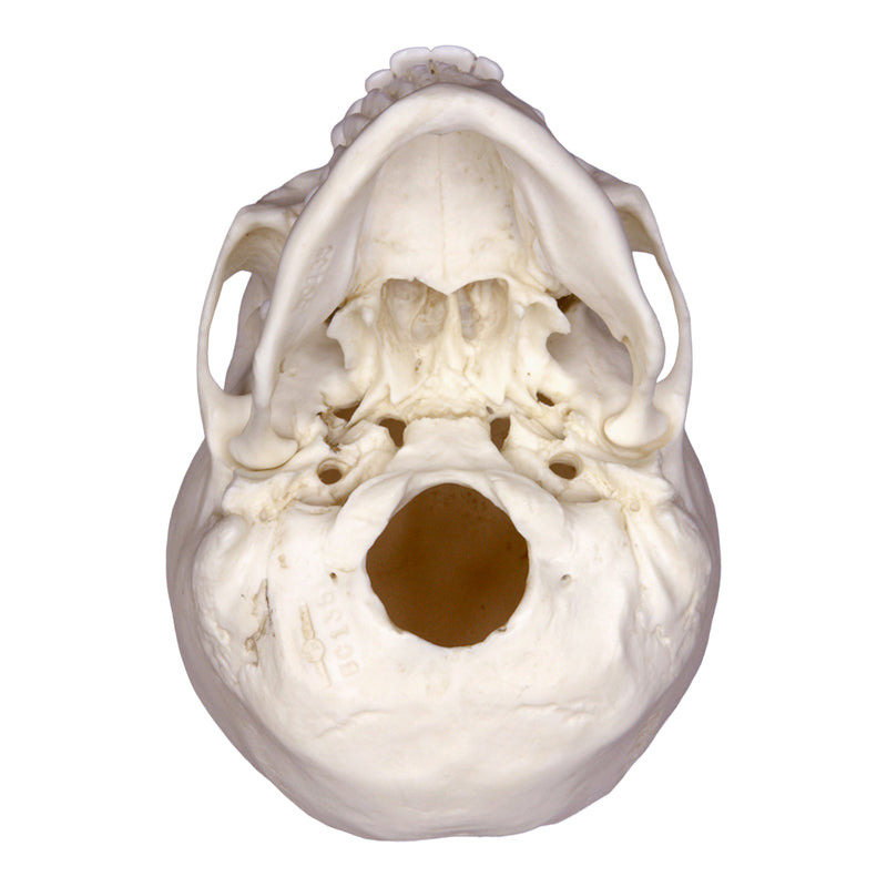 Replica 12-year-old Human Child with Dentition Exposed