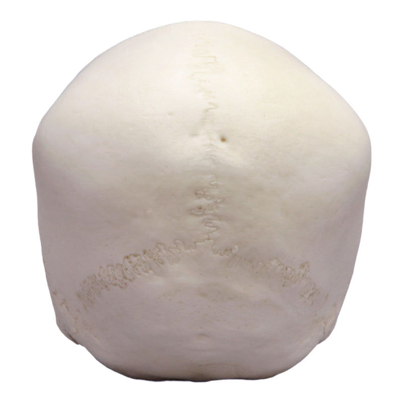 Replica 12-year-old Human Child with Dentition Exposed