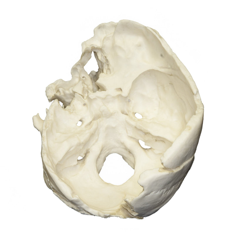 Replica Human Male with Machete Wounds Skull