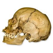 Replica Human Female with Shotgun Wounds Skull