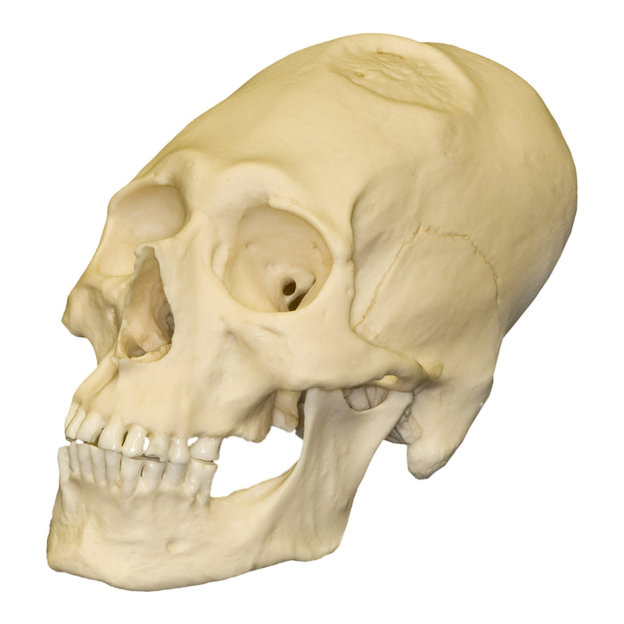 Replica Human Peruvian Male Skull with Cranial Binding & Trephination