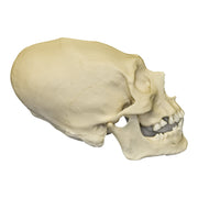 Replica Human Peruvian Male Skull with Cranial Binding & Trephination