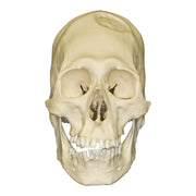 Replica Human Peruvian Male Skull with Cranial Binding & Trephination