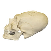 Replica Human Peruvian Male Skull with Cranial Binding & Trephination