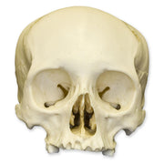 Replica Human Adult Cradle-boarded Skull