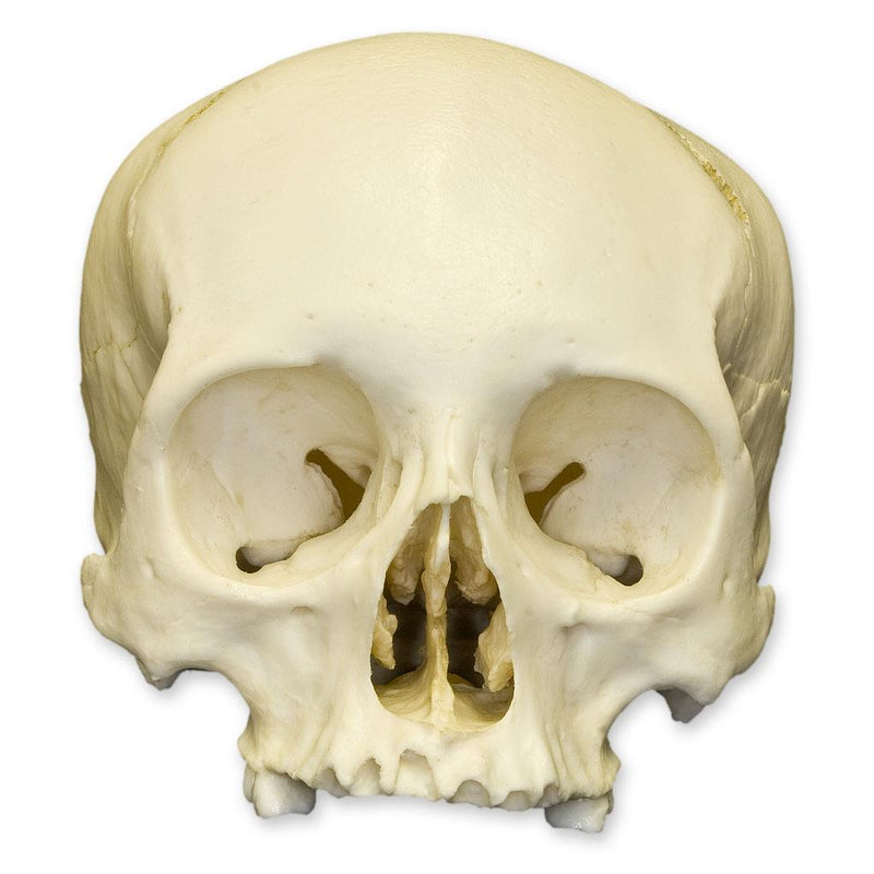 Replica Human Adult Cradle-boarded Skull