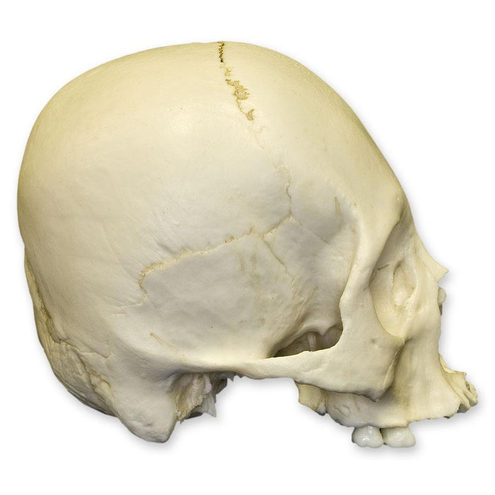 Replica Human Adult Cradle-boarded Skull