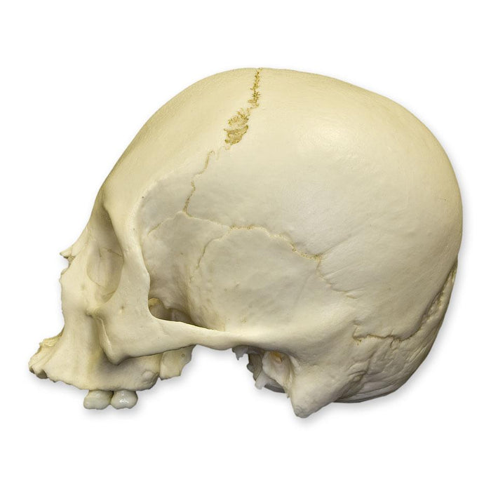Replica Human Adult Cradle-boarded Skull