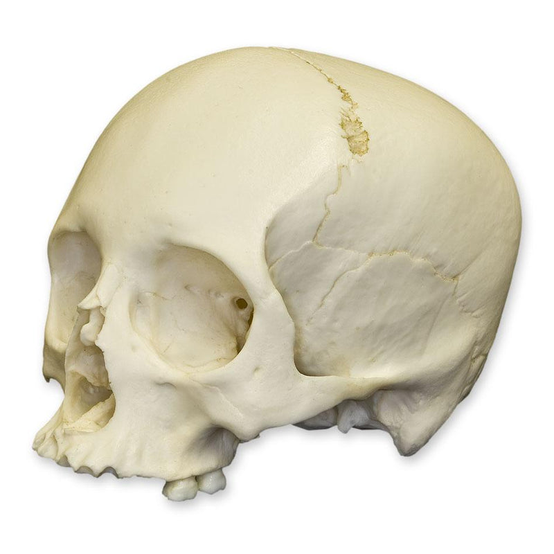 Replica Human Adult Cradle-boarded Skull