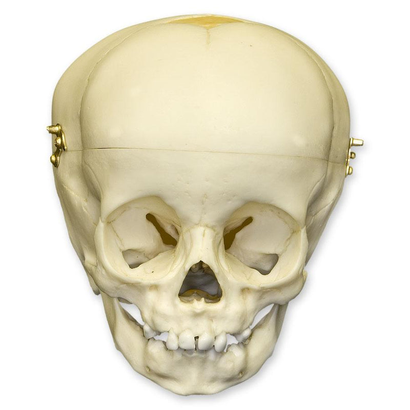 Replica 1-year-old Human Child Skull - Calvarium Cut