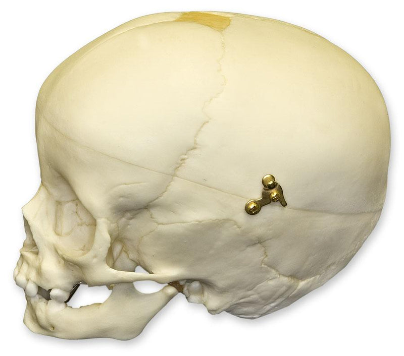 Replica 1-year-old Human Child Skull - Calvarium Cut