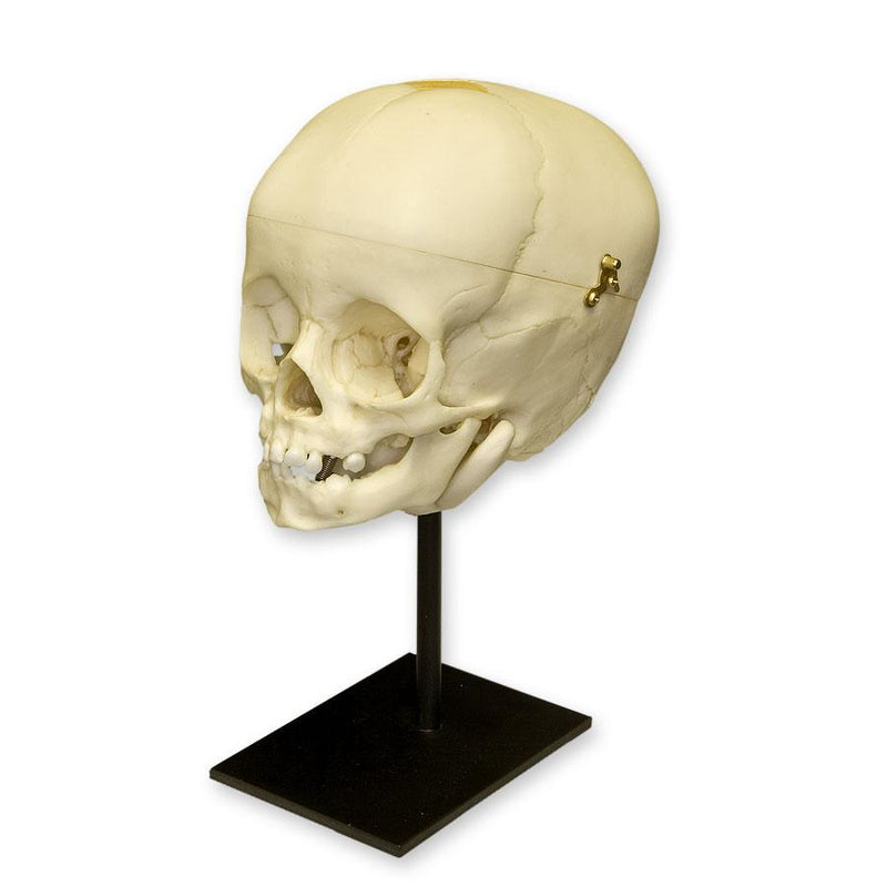 Replica 1-year-old Human Child Skull - Calvarium Cut