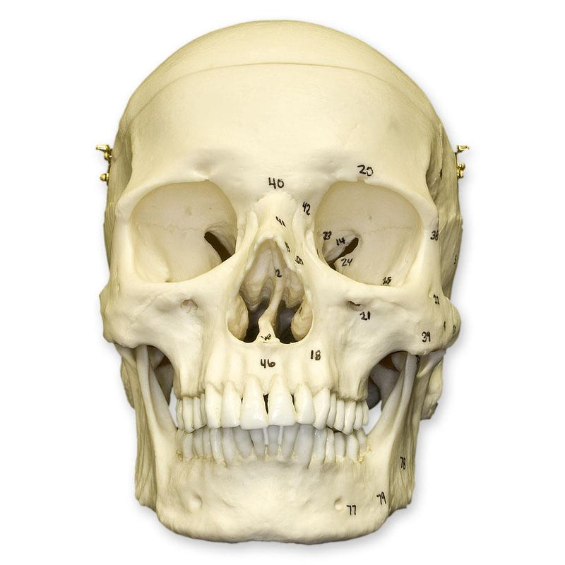 Replica Human European Male Skull - Calvarium Cut and Numbered