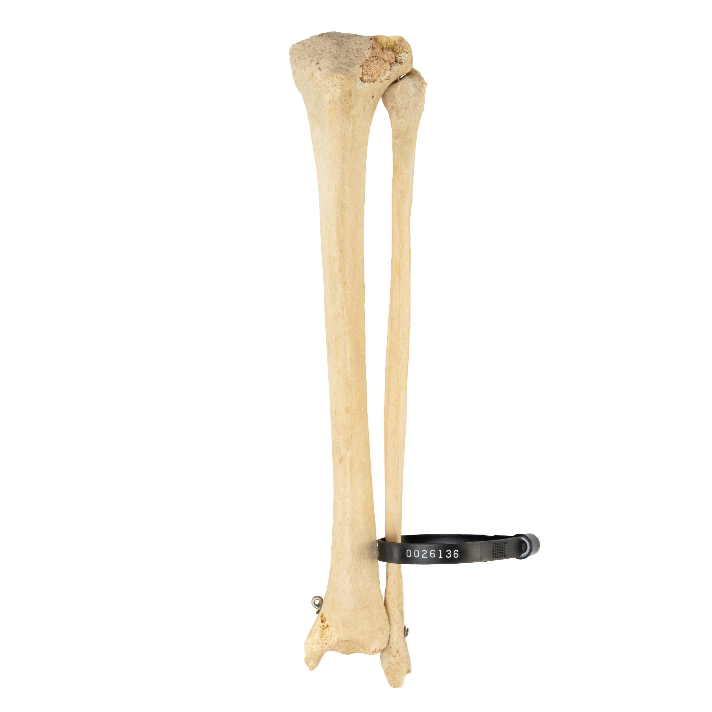 Fibula Bones