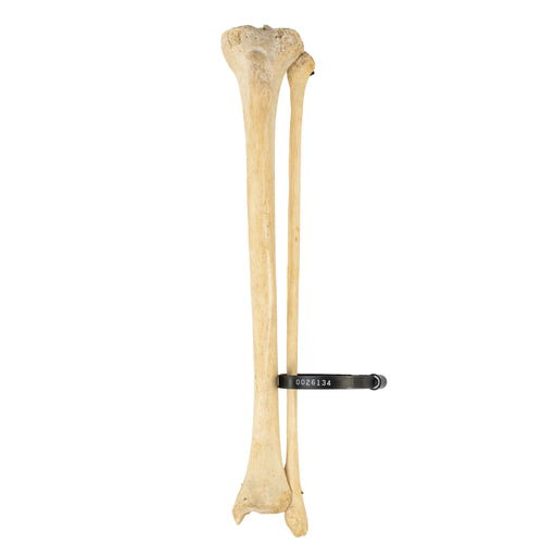 Real Human Tibia and Fibula