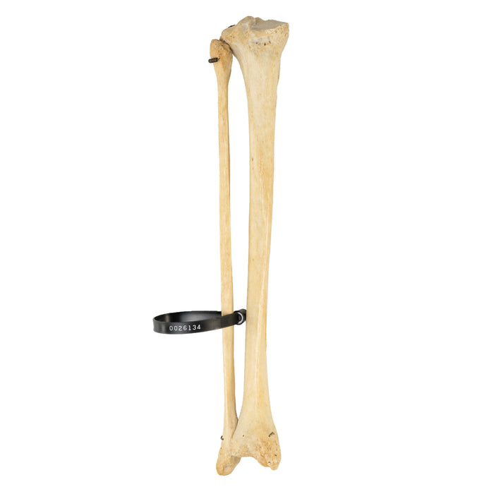 Tibia Snap Human Tibia