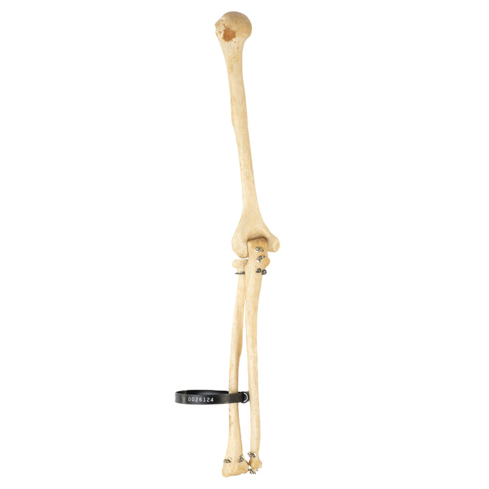 Real Human Humerus, Radius, and Ulna