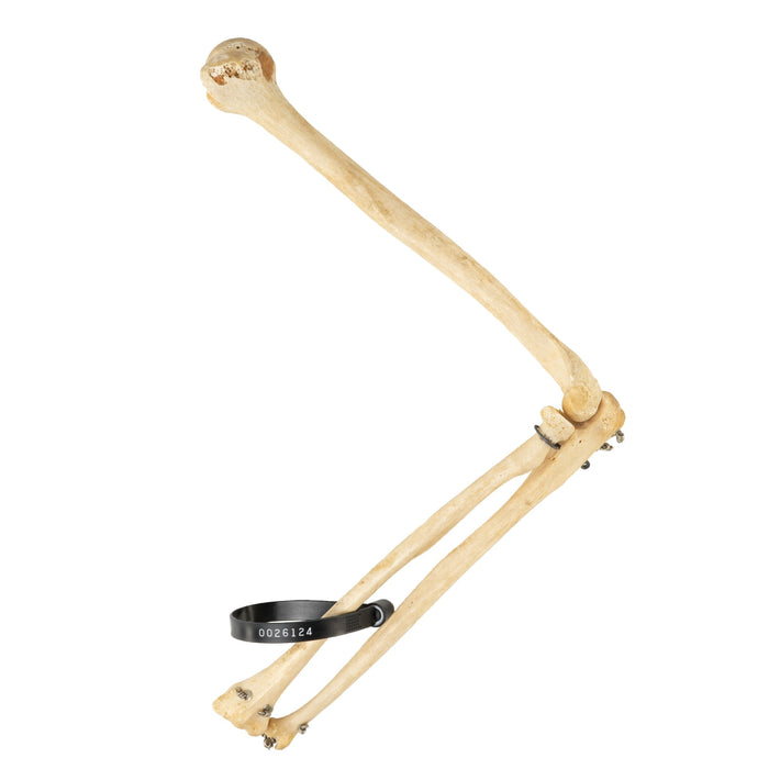 Real Human Humerus, Radius, and Ulna