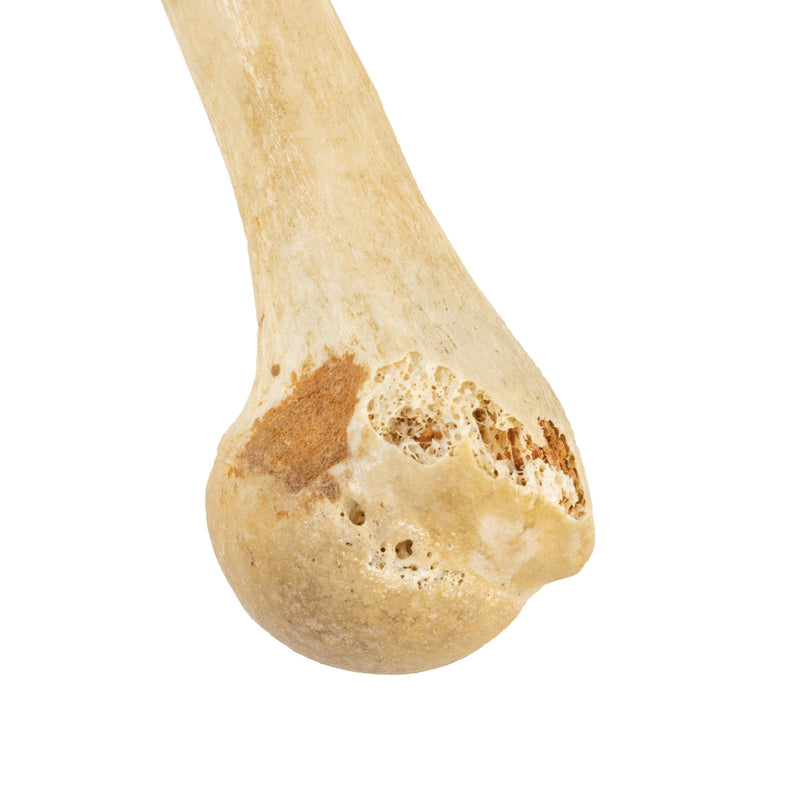 Real Human Humerus, Radius, and Ulna