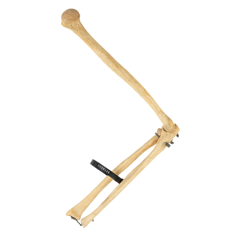 Real Human Humerus, Radius, and Ulna