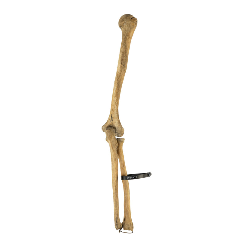 Real Human Humerus, Radius, and Ulna