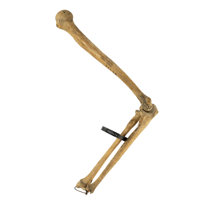 Real Human Humerus, Radius, and Ulna