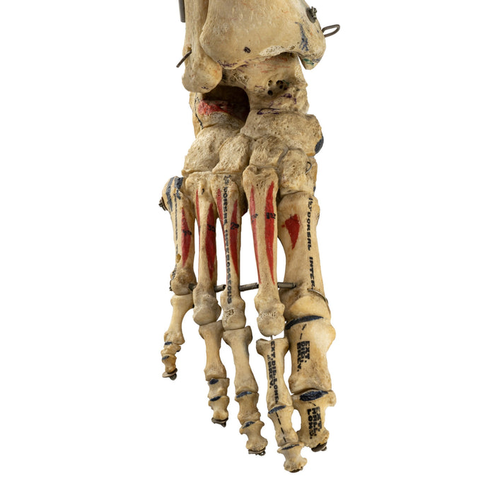Real Human Tibia, Fibula, and Foot with Muscles