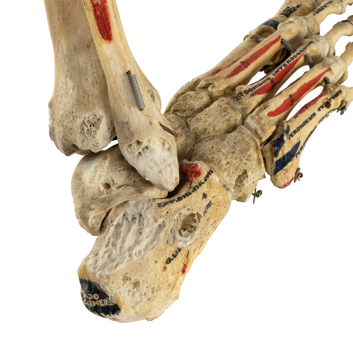 Real Human Tibia, Fibula, and Foot with Muscles