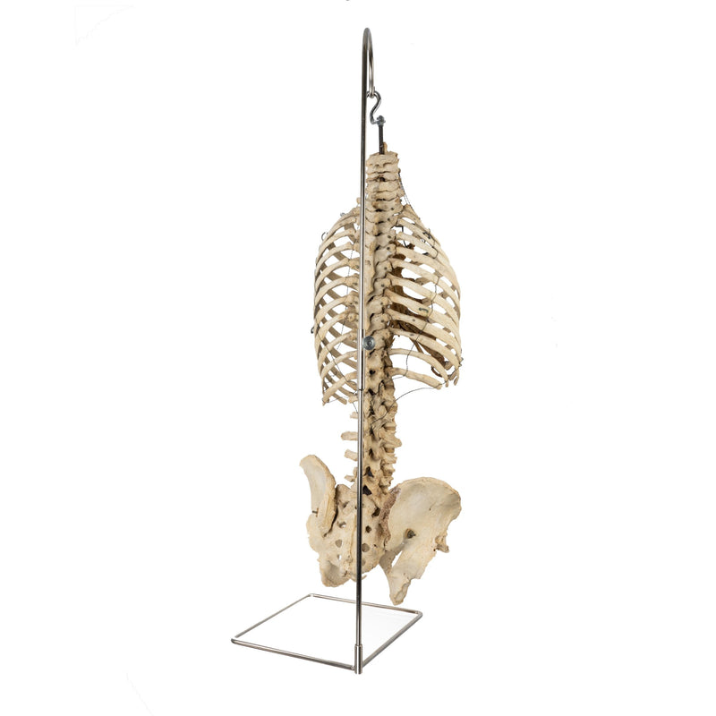 Real Human Torso and Pelvis on Stand