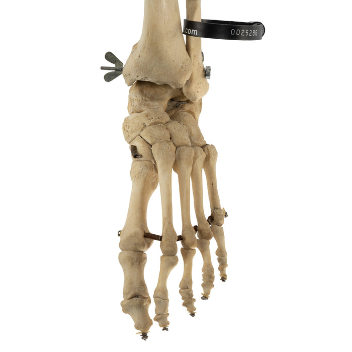 Real Leg Bones
