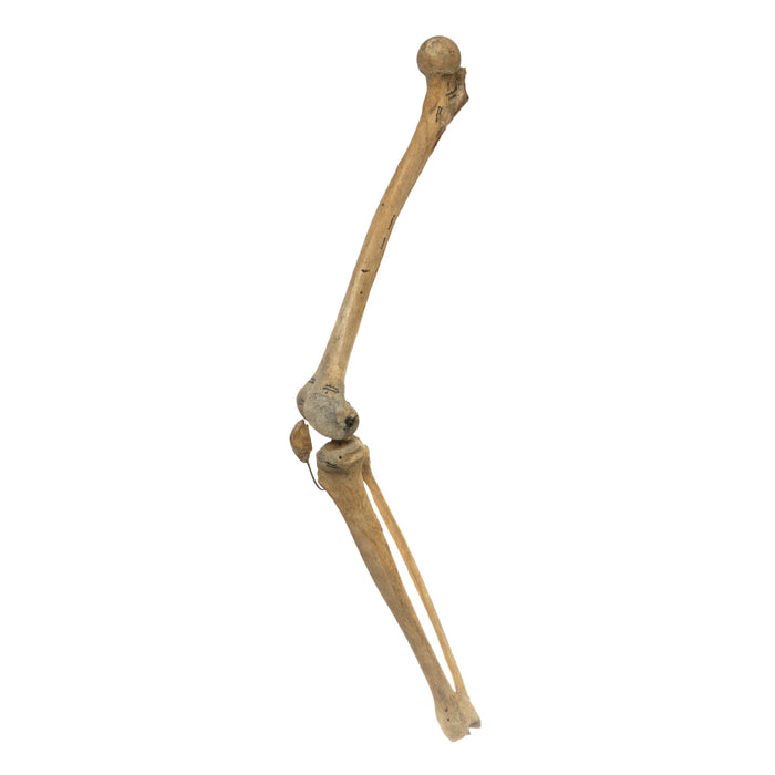 Real Human Femur, Patella, Tibia, and Fibula