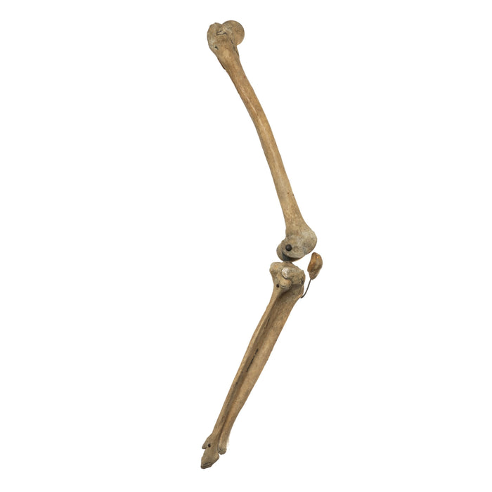 Real Human Femur, Patella, Tibia, and Fibula