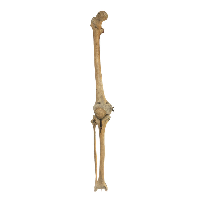 Real Human Femur, Patella, Tibia, and Fibula