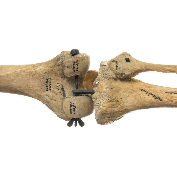 Real Human Femur, Patella, Tibia, and Fibula