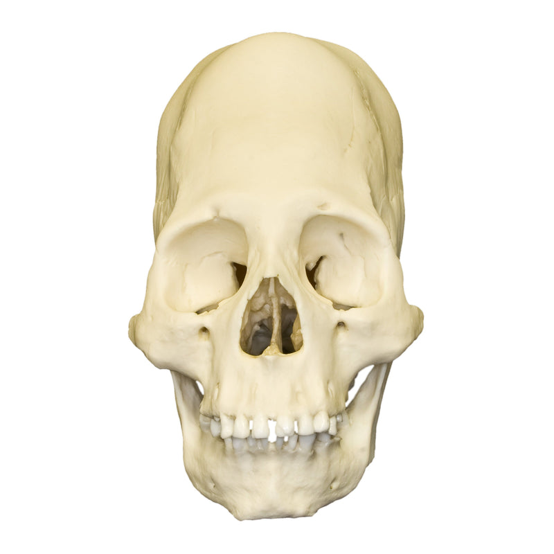 Replica Human Peruvian Female Skull with Cranial Binding