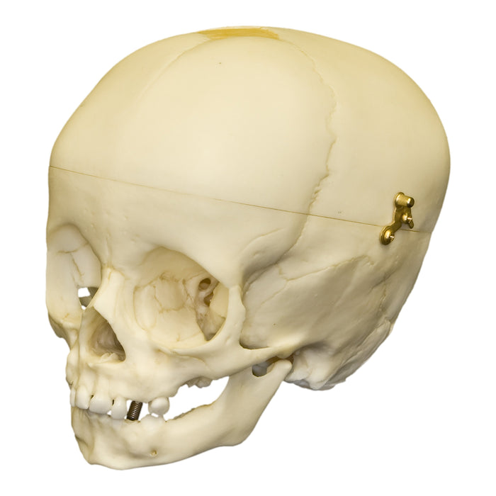 Replica 1-year-old Human Child Skull - Calvarium Cut