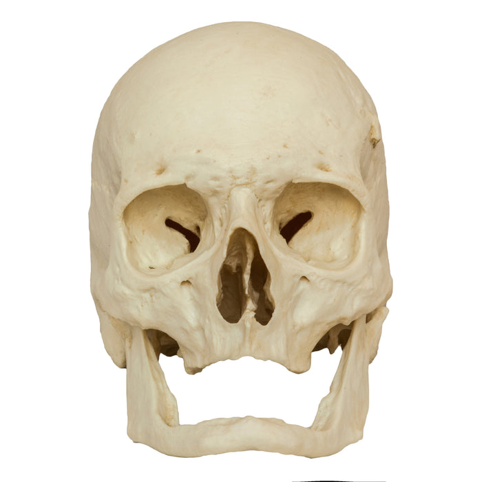 Replica Human Skull - Elderly European Male