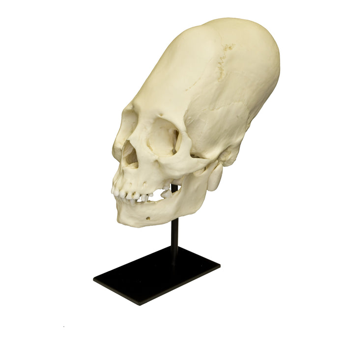 Replica Human Peruvian Female Skull with Cranial Binding