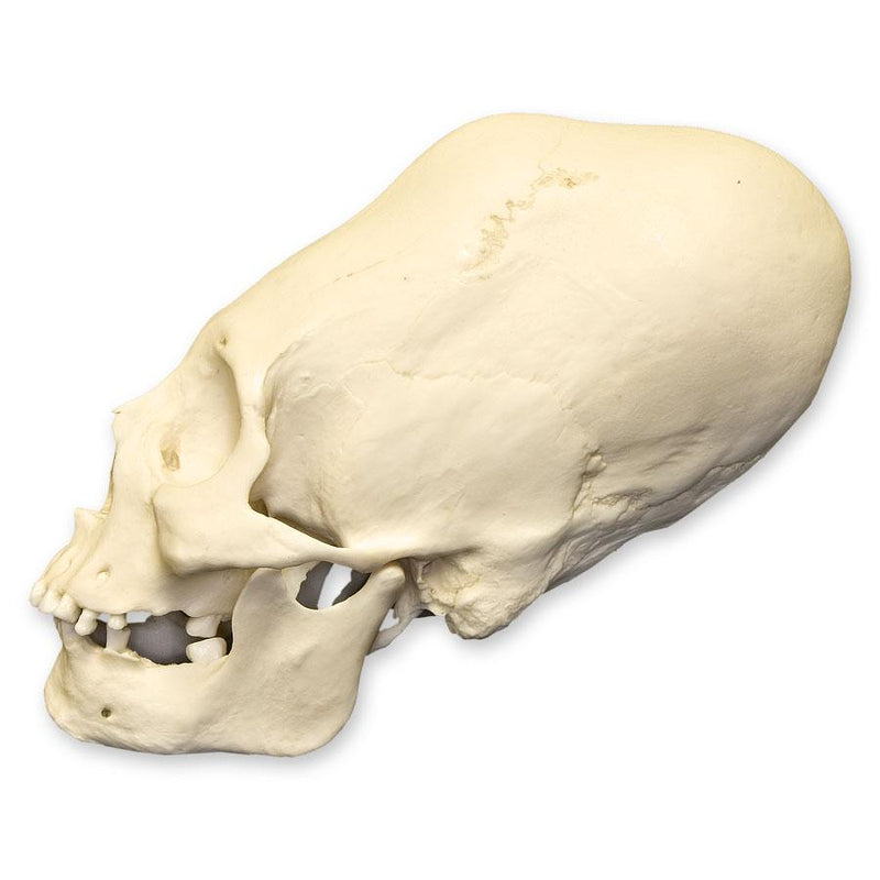 Replica Human Peruvian Female Skull with Cranial Binding