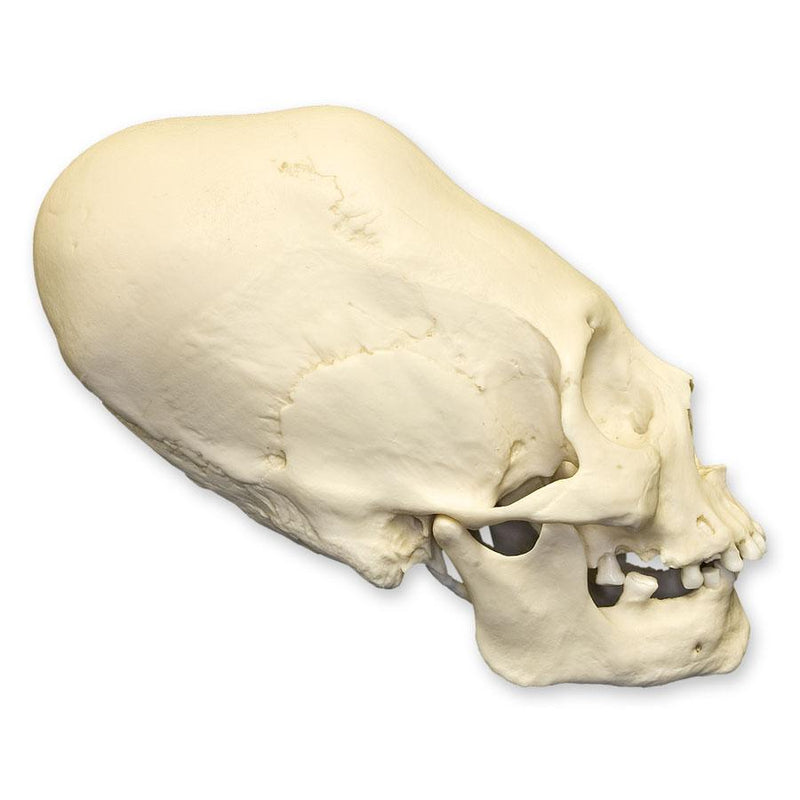 Replica Human Peruvian Female Skull with Cranial Binding