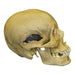 Replica Human Female with Multiple Gunshot Wounds Skull