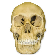 Replica Human Female with Multiple Gunshot Wounds Skull