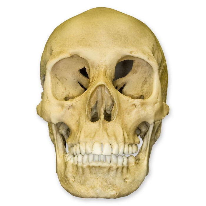 Replica Human Female with Multiple Gunshot Wounds Skull