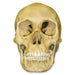 Replica Human Female with Multiple Gunshot Wounds Skull