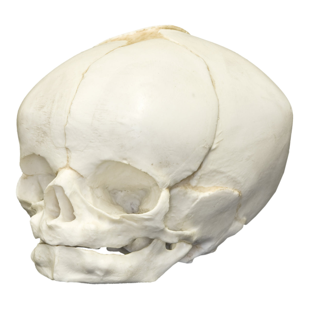 DimMoire Baby Skull BIG T【White】　未開封 Human-Fetal-40-1-1_2-Weeks--