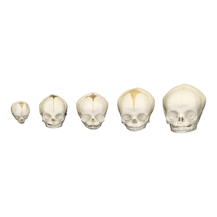 Replica Human Fetal Skulls - Set of 5