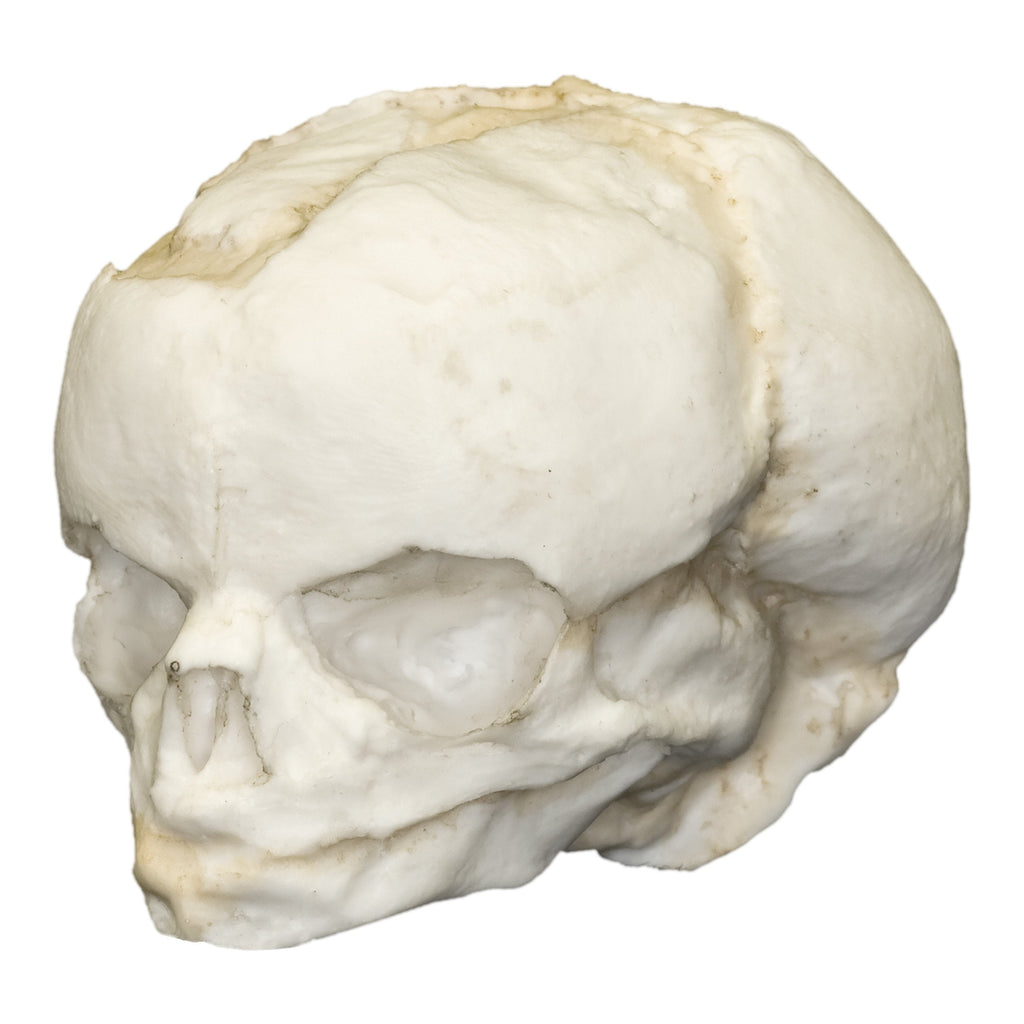 DimMoire Baby Skull BIG T【White】　未開封 Replica Human Fetal Skull (17 Weeks) For Sale — Skulls Unlimited