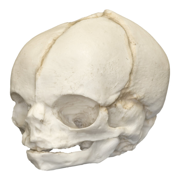 Replica Human Fetal Skull - 21 1/2 Weeks
